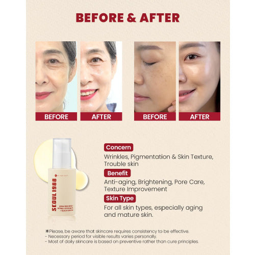 Suero SEOUL 1988: Liposoma de retina al 2% + Ginseng negro