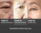 Peptide 9 Volume Lif-Tox Eye